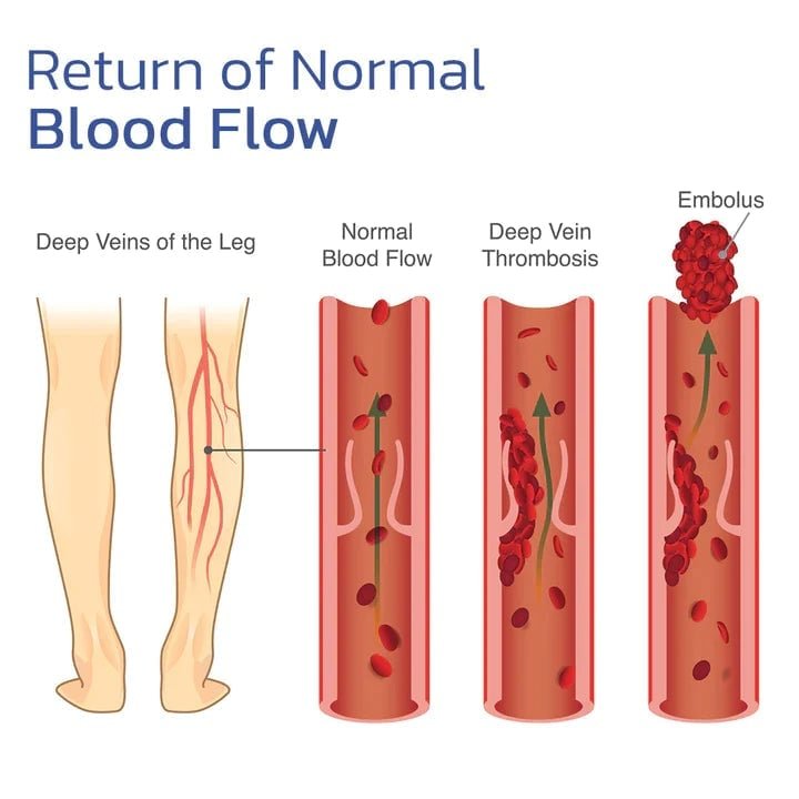Selbstheizendes Knieband: schnelle Linderung von Schmerzen