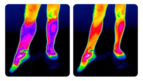 Selbstheizendes Knieband: schnelle Linderung von Schmerzen