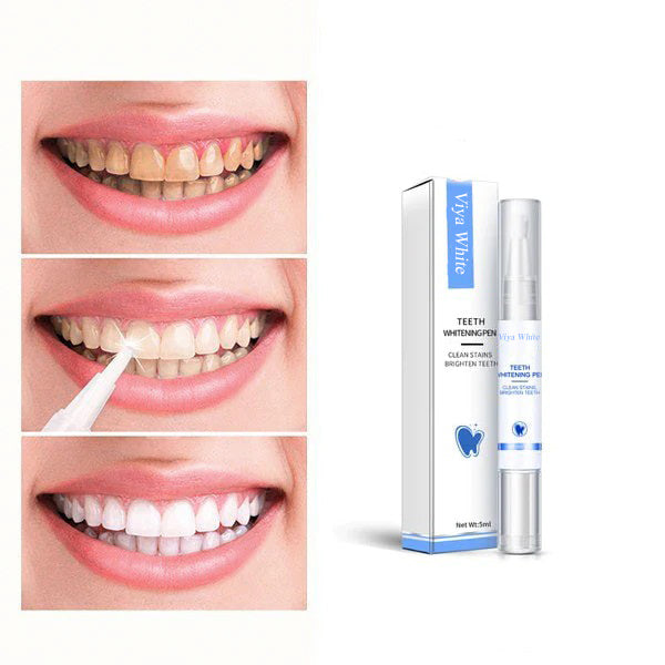 Sbiancamento dei denti rapido per un sorriso splendente
